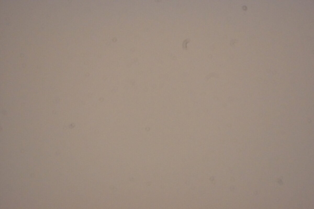 A flat grey photo with a few faint dust rings and no stars